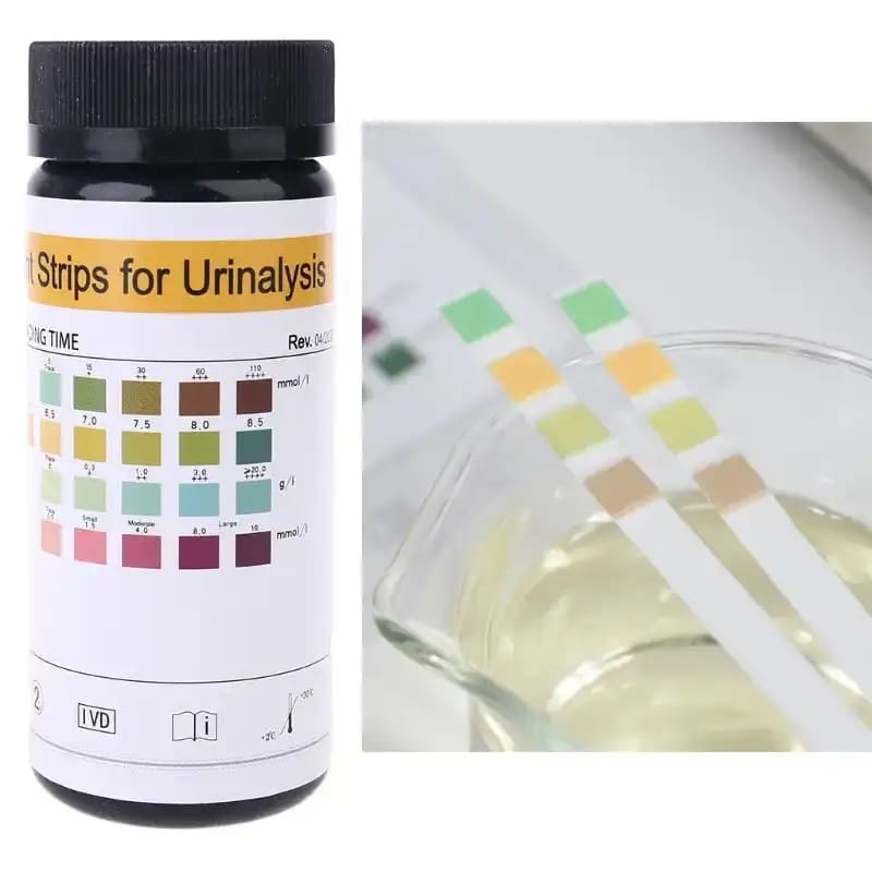 100 Strips URS 4K Urinalysis Reagent Strips 4 Parameters