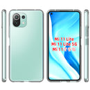 Xiaomi Mi 11 Lite 5G Case