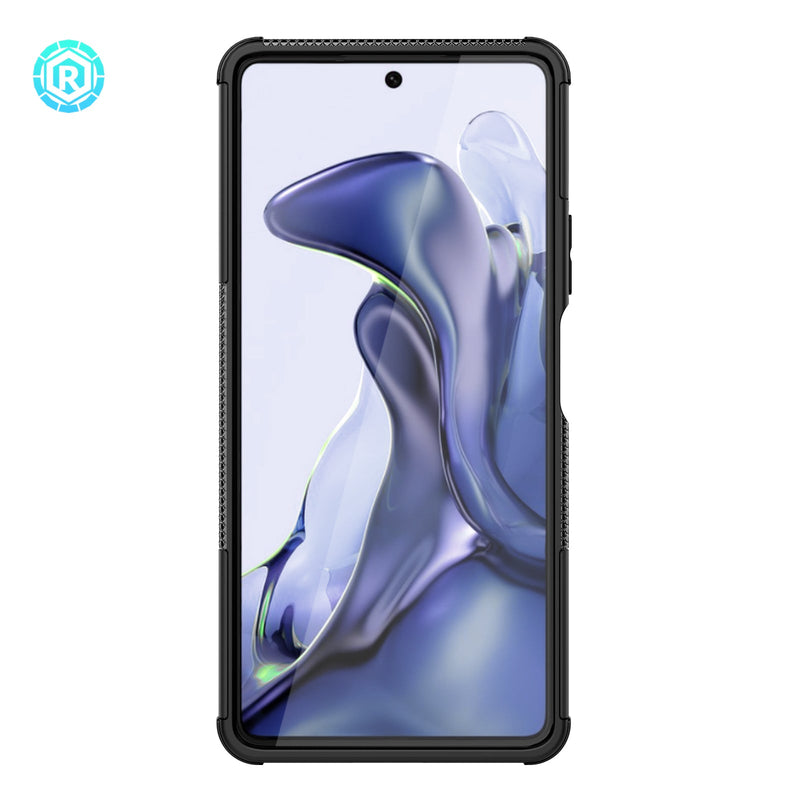 Xiaomi 11T Case