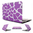 MacBook Air 11’’ (2012-2015) A1465 Designer Hard Case