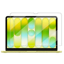 MacBook Neo 13“ (A18 Pro 2026) Tempered Glass Screen