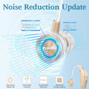 Rechargeable Hearing Aids 3